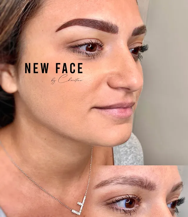 Correction & Cover-up result by New Face by Christine, NYC — photo 6