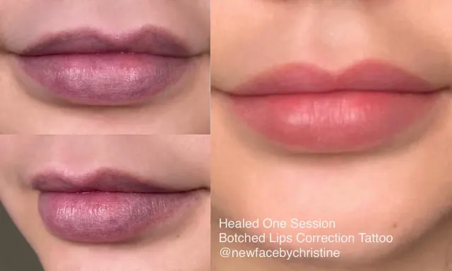Correction & Cover-up result by New Face by Christine, NYC — photo 7