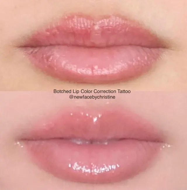 Correction & Cover-up result by New Face by Christine, NYC — photo 9
