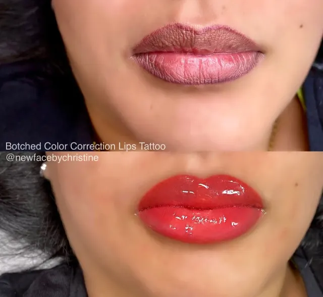 Correction & Cover-up result by New Face by Christine, NYC — photo 12