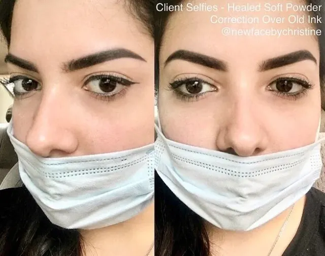 Correction & Cover-up result by New Face by Christine, NYC — photo 28