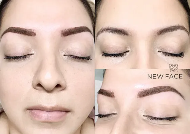 Correction & Cover-up result by New Face by Christine, NYC — photo 32