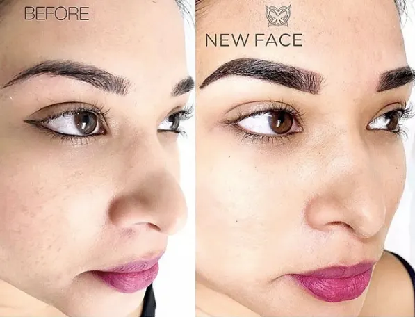 Correction & Cover-up result by New Face by Christine, NYC — photo 37