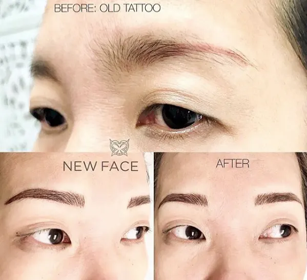 Correction & Cover-up result by New Face by Christine, NYC — photo 40