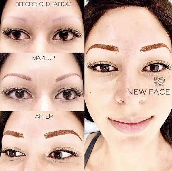 Correction & Cover-up result by New Face by Christine, NYC — photo 41