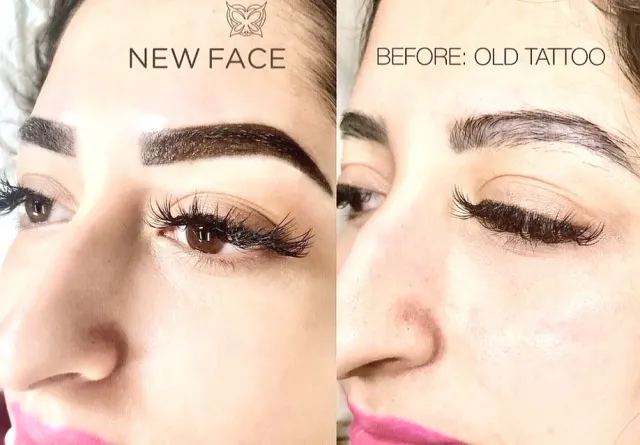 Correction & Cover-up result by New Face by Christine, NYC — photo 42