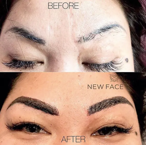 Correction & Cover-up result by New Face by Christine, NYC — photo 47
