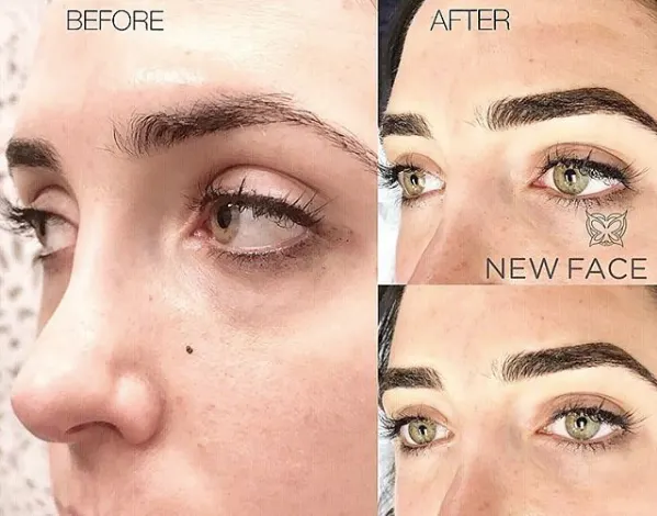 Combo Brows / Microshading result by New Face by Christine, NYC — photo 50