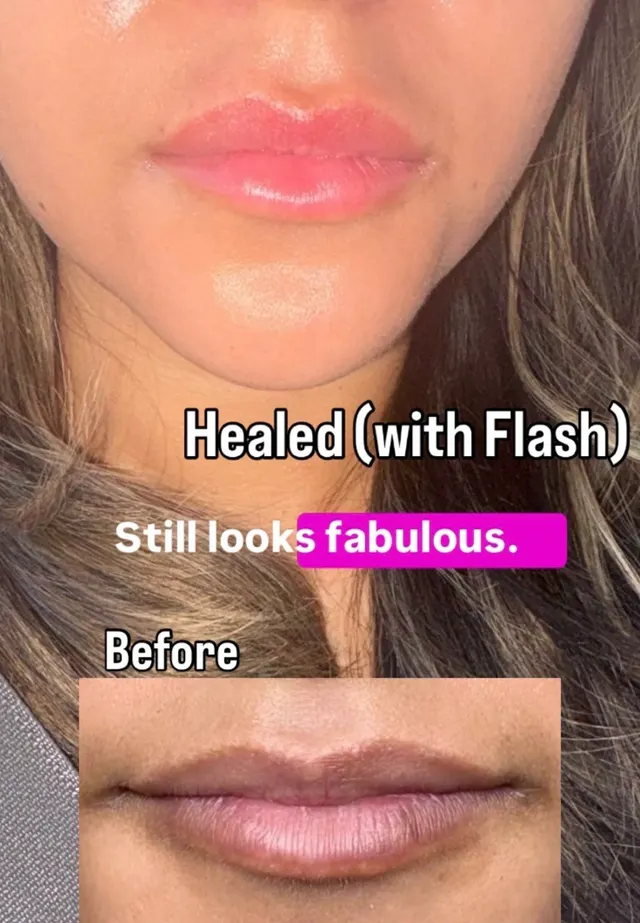 Dark Lips Neutralization result by New Face by Christine, NYC — photo 10