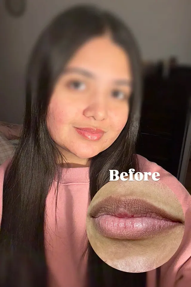 Dark Lips Neutralization result by New Face by Christine, NYC — photo 12