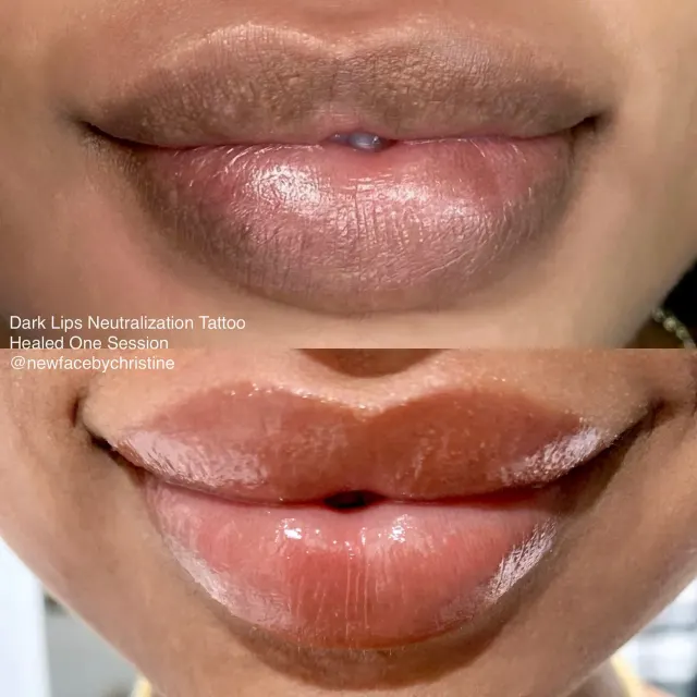 Dark Lips Neutralization result by New Face by Christine, NYC — photo 13