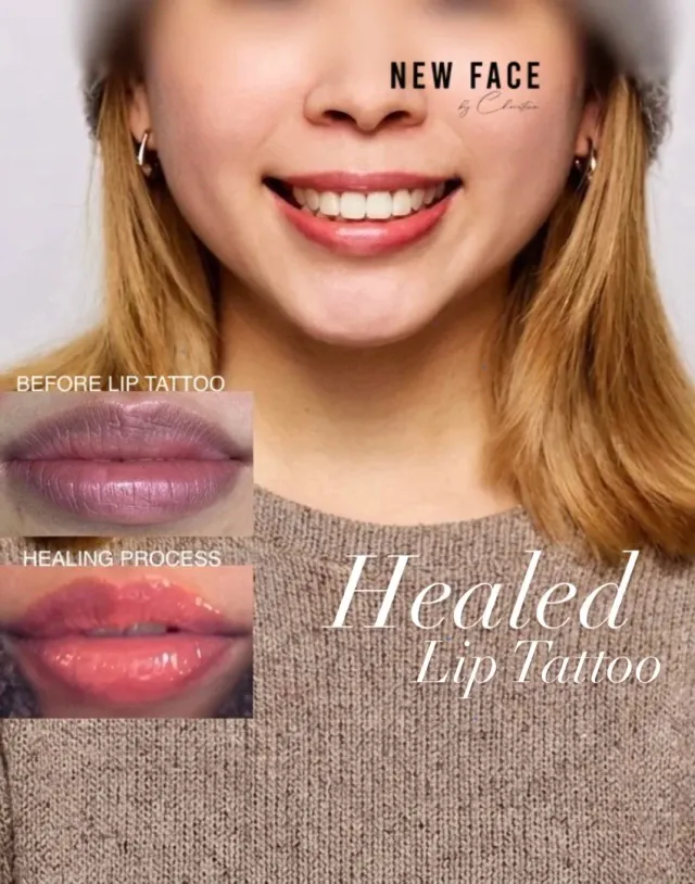 Dark Lips Neutralization result by New Face by Christine, NYC — photo 15
