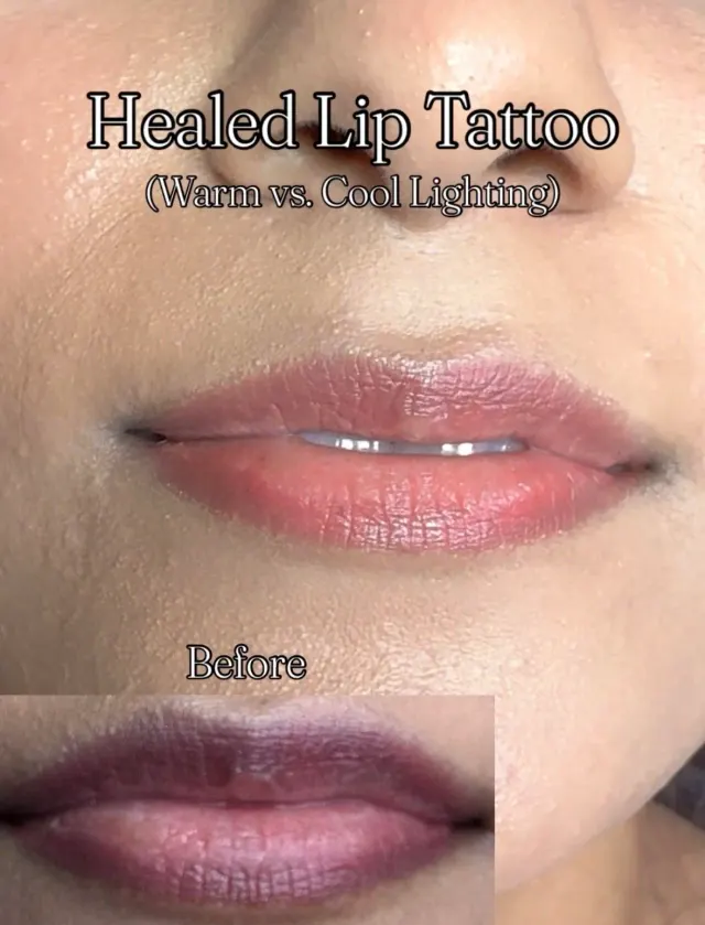 Dark Lips Neutralization result by New Face by Christine, NYC — photo 23