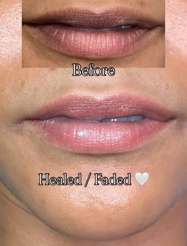 Dark Lips Neutralization result by New Face by Christine, NYC — photo 34