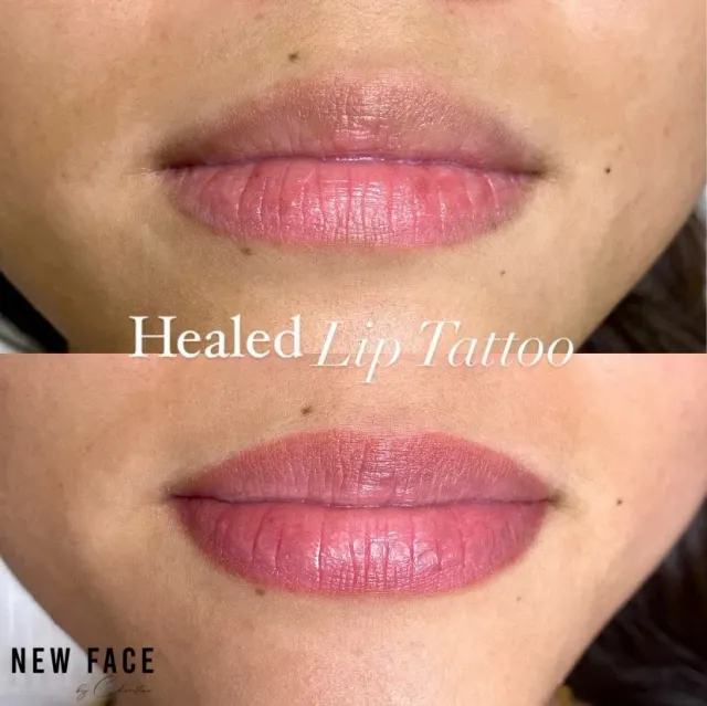 Dark Lips Neutralization result by New Face by Christine, NYC — photo 36