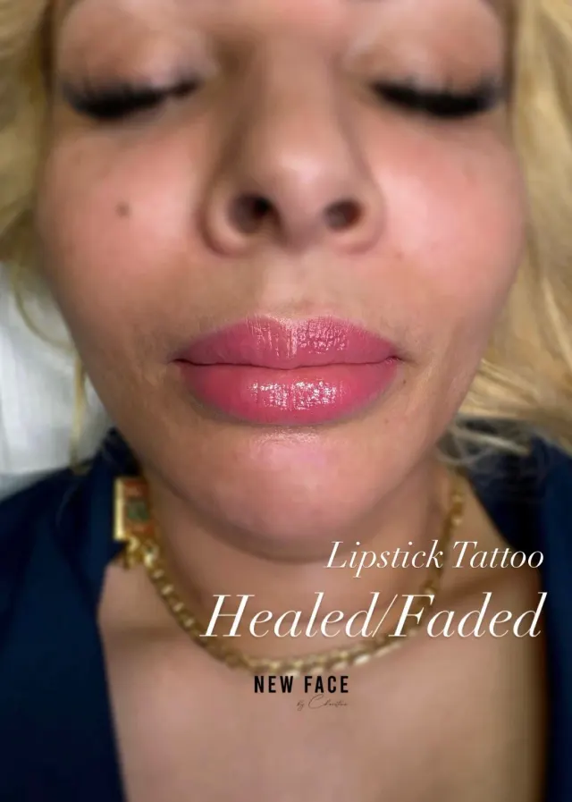 Dark Lips Neutralization result by New Face by Christine, NYC — photo 38