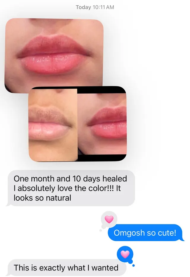 Dark Lips Neutralization result by New Face by Christine, NYC — photo 50