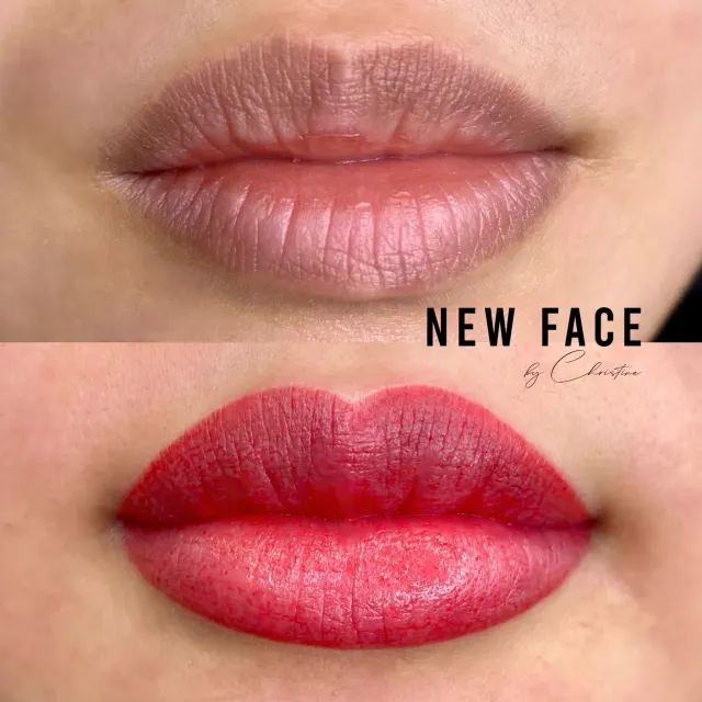 Dark Lips Neutralization result by New Face by Christine, NYC — photo 61