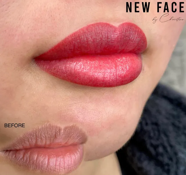 Dark Lips Neutralization result by New Face by Christine, NYC — photo 74