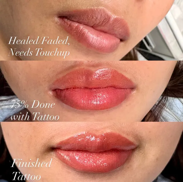 Dark Lips Neutralization result by New Face by Christine, NYC — photo 76