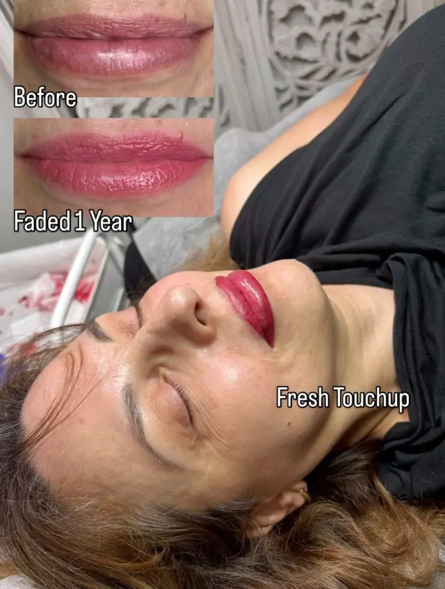 Dark Lips Neutralization result by New Face by Christine, NYC — photo 83