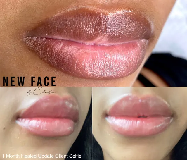 Dark Lips Neutralization result by New Face by Christine, NYC — photo 86