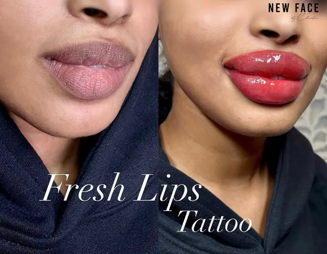Dark Lips Neutralization result by New Face by Christine, NYC — photo 88