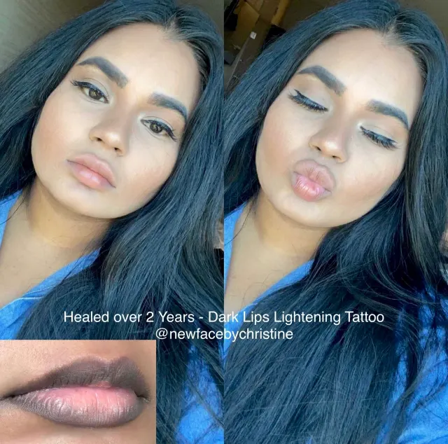 Dark Lips Neutralization result by New Face by Christine, NYC — photo 89
