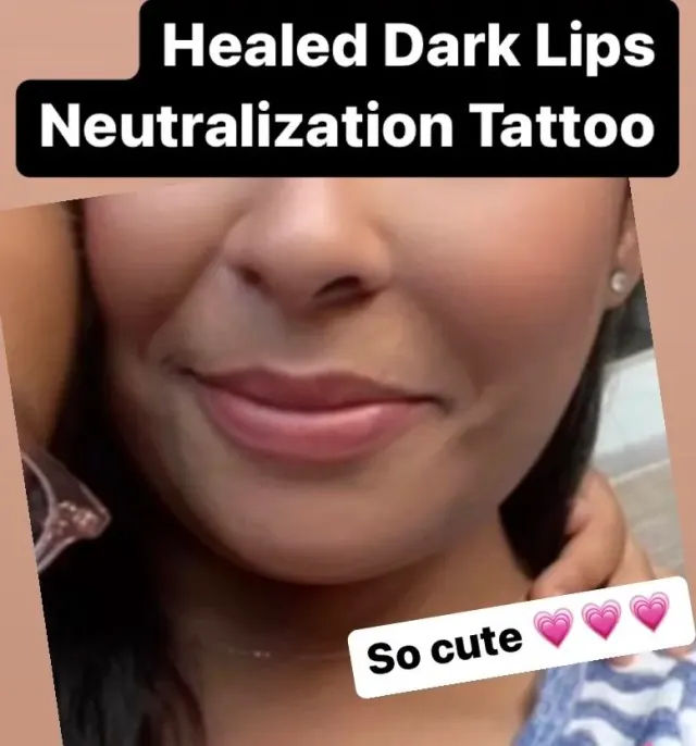Dark Lips Neutralization result by New Face by Christine, NYC — photo 95