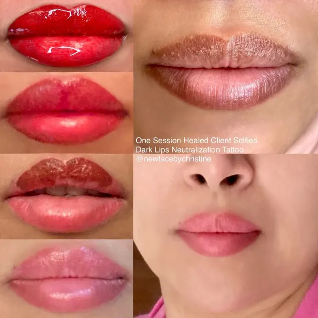 Dark Lips Neutralization result by New Face by Christine, NYC — photo 106