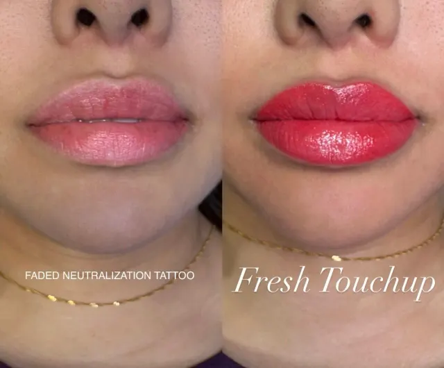Dark Lips Neutralization result by New Face by Christine, NYC — photo 109