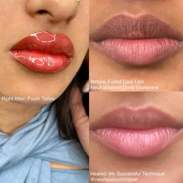 Dark Lips Neutralization result by New Face by Christine, NYC — photo 113