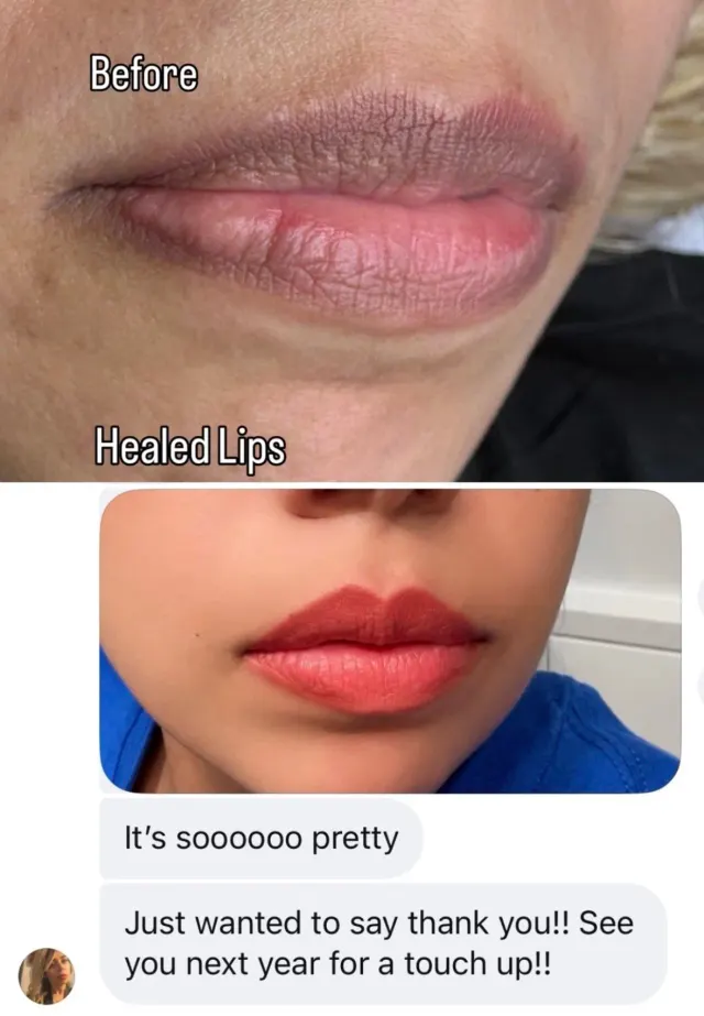 Dark Lips Neutralization result by New Face by Christine, NYC — photo 114