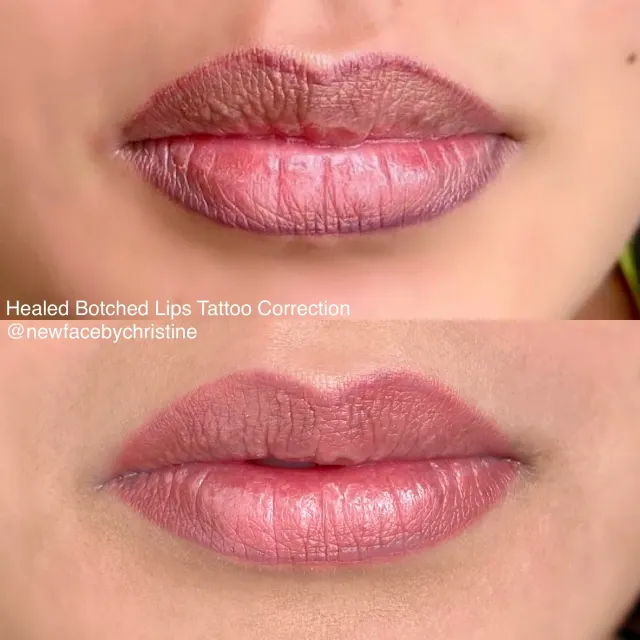 Dark Lips Neutralization result by New Face by Christine, NYC — photo 116