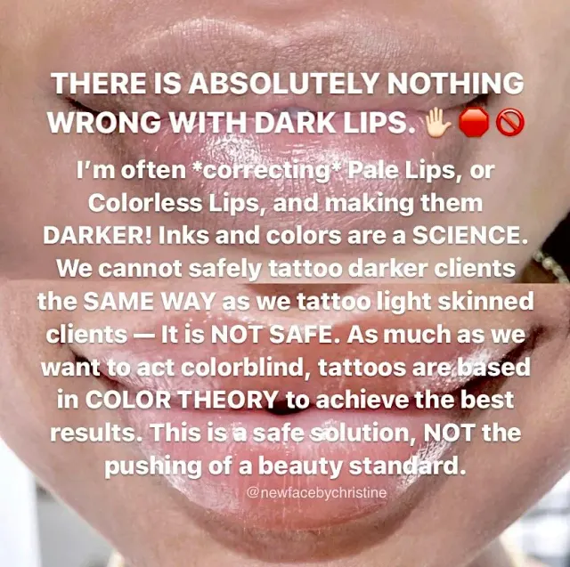 Dark Lips Neutralization result by New Face by Christine, NYC — photo 126
