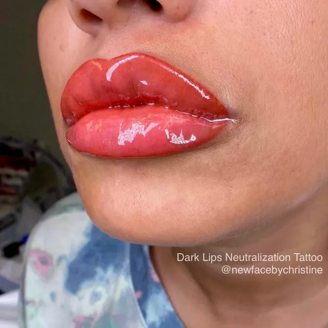 Dark Lips Neutralization result by New Face by Christine, NYC — photo 129