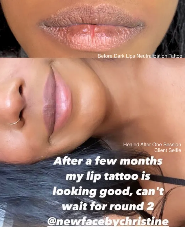 Dark Lips Neutralization result by New Face by Christine, NYC — photo 131