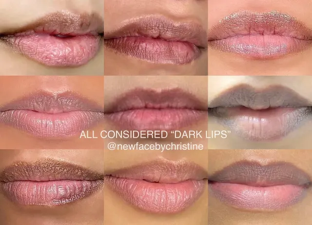 Dark Lips Neutralization result by New Face by Christine, NYC — photo 132