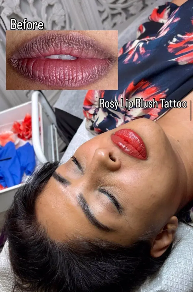 Dark Lips Neutralization result by New Face by Christine, NYC — photo 138