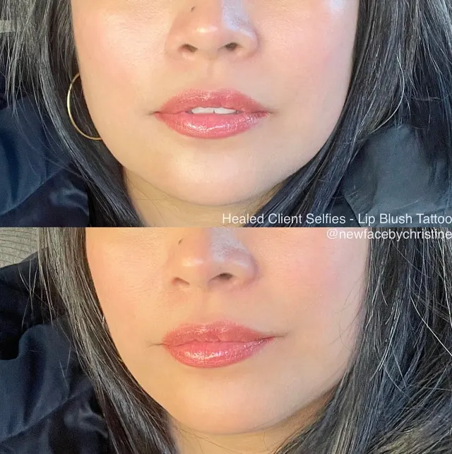 Dark Lips Neutralization result by New Face by Christine, NYC — photo 141