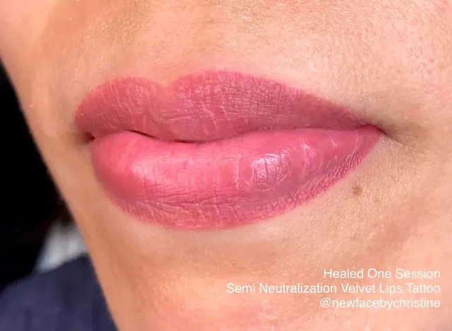 Dark Lips Neutralization result by New Face by Christine, NYC — photo 142