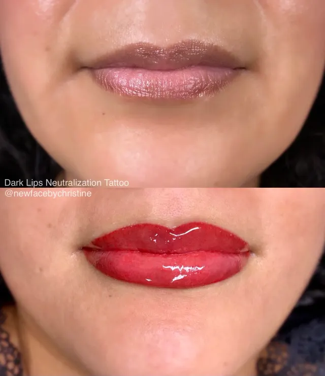 Dark Lips Neutralization result by New Face by Christine, NYC — photo 145