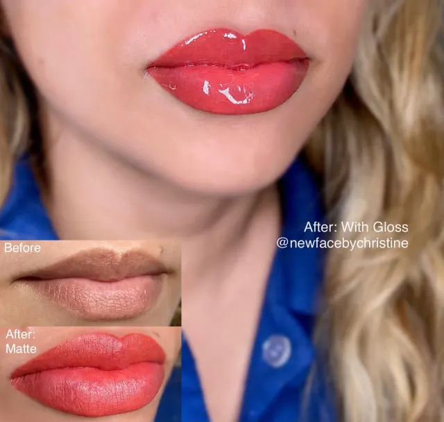 Dark Lips Neutralization result by New Face by Christine, NYC — photo 148
