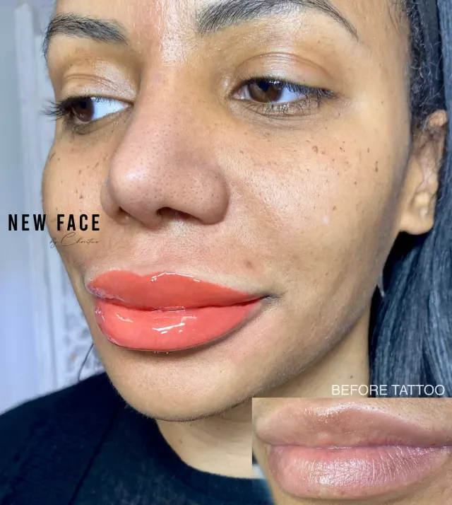 Dark Lips Neutralization result by New Face by Christine, NYC — photo 150
