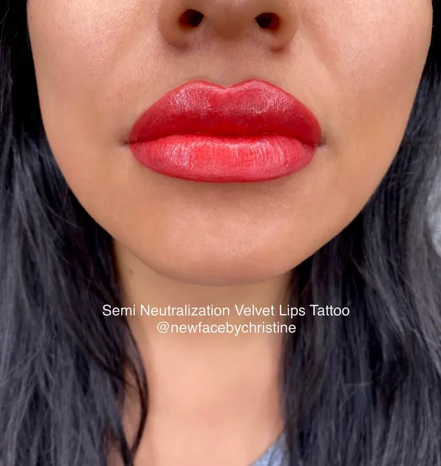 Dark Lips Neutralization result by New Face by Christine, NYC — photo 151