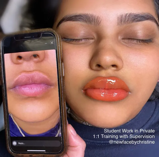 Dark Lips Neutralization result by New Face by Christine, NYC — photo 152
