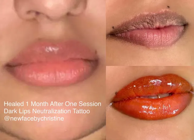 Dark Lips Neutralization result by New Face by Christine, NYC — photo 154