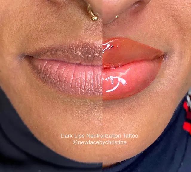 Dark Lips Neutralization result by New Face by Christine, NYC — photo 157