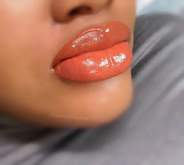Dark Lips Neutralization result by New Face by Christine, NYC — photo 165