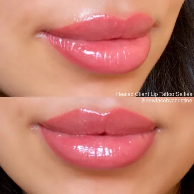 Dark Lips Neutralization result by New Face by Christine, NYC — photo 170
